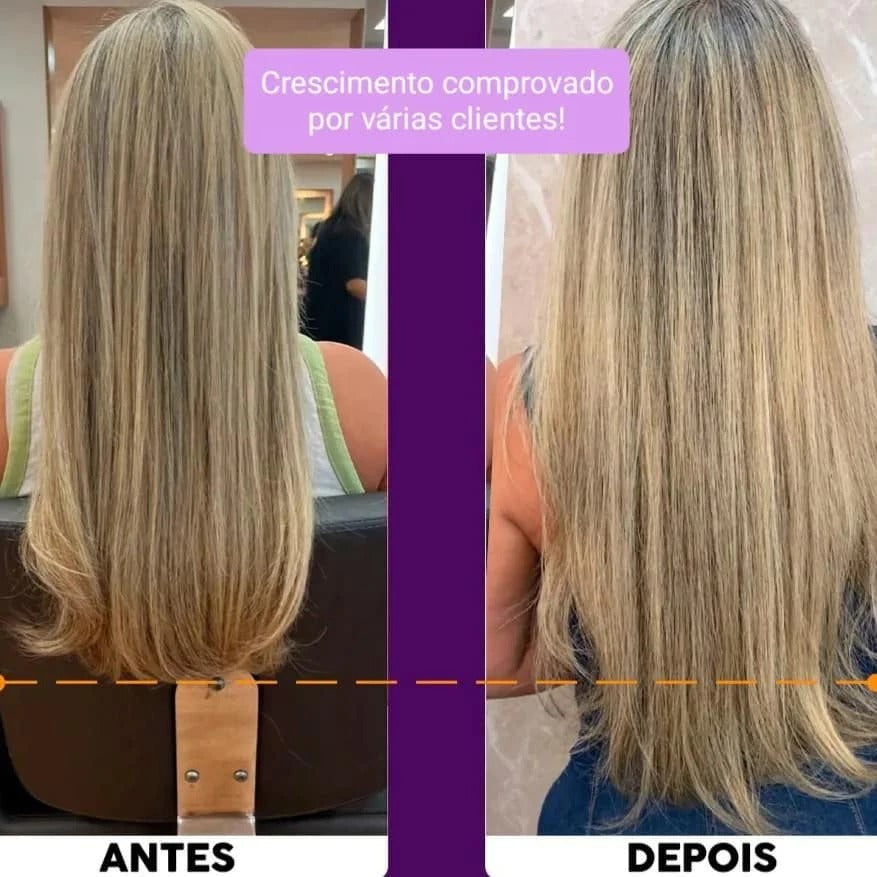 Kit Crescimento Capilar Completo Biovin-A Força de Cavalo + Tônico Crescimento e Creme p/ pentear L&A